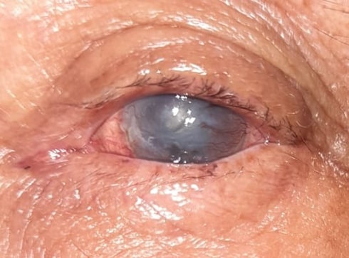 Cataratas
